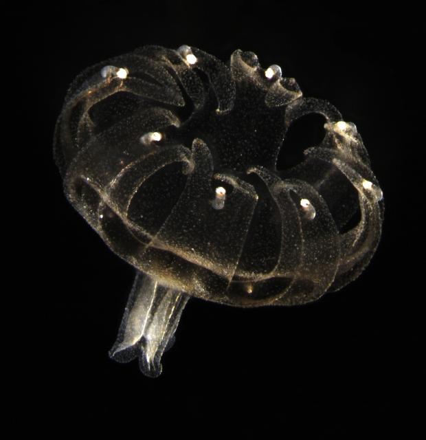 Microphoto (20x) of one month old jellyfish (Aurelia aurita).

SpineInWine, CC BY-SA 4.0, via Wikimedia Commons.