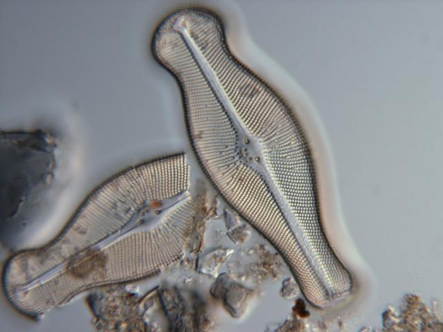 "Image of the silica cell wall of the diatom Didymosphenia geminata from Rio Espolon, Chile."

Photographer: Sarah Spaulding, USGS, Public domain, via Wikimedia Commons.