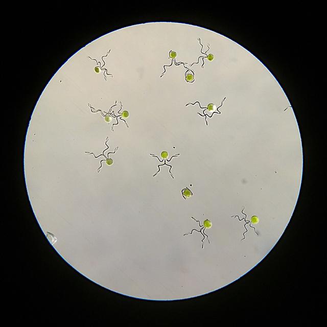 Circular photo taken with a microscope, so a round white field in a black square. In the white field are fern spores, small green circular things, each with four short zigzagging threads coming out from them, in some cases making the spores look like little shrugging figures.