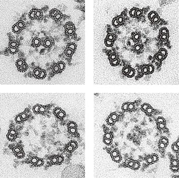 Transmission electron microscopy images showing cross-sections of axonemal microtubules in Chlamydomonas reinhardtii flagella. Axonemes from mutants in which beta-tubulin cannot be glycylated often lack central microtubules resulting in truncated, paralyzed flagella.