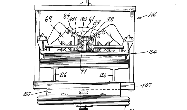 Illustration from the patent application with a front-on view of the spread legs strapped into a machine. A net covers the vagina and vulva.