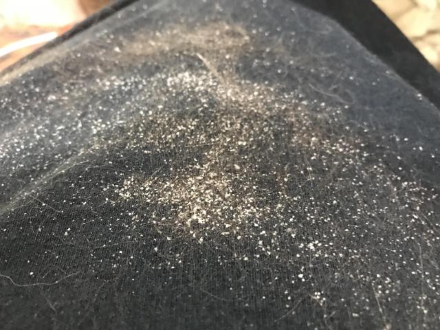 Photo of author’s black t-shirt covered in dandruff-like flakes and fur from Mr Kitty’s seborrhea due to the oral SCC preventing him from grooming properly.