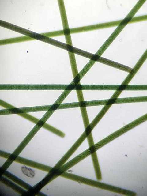 Microscopy image of long dark green threads of oscillatoria algae