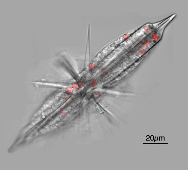 image/png a microscopic image of a transparent elongated organism with spines radiating from the center, with distinctly red spherical dots inside. Size bar of 20 microns suggests the organism is 200 microns long.

Fluorescent micrograph of an acantharian with Phaeocystis symbionts.
https://commons.m.wikimedia.org/wiki/File:Acantharia_confocial_micrograph_2.png