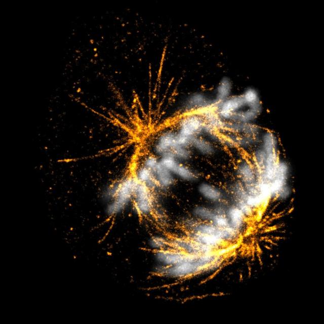 Expanded COS7 during division, superesolved microtubules in gold, compacted DNA in gray