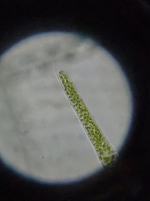 Ciliate with algae inside?