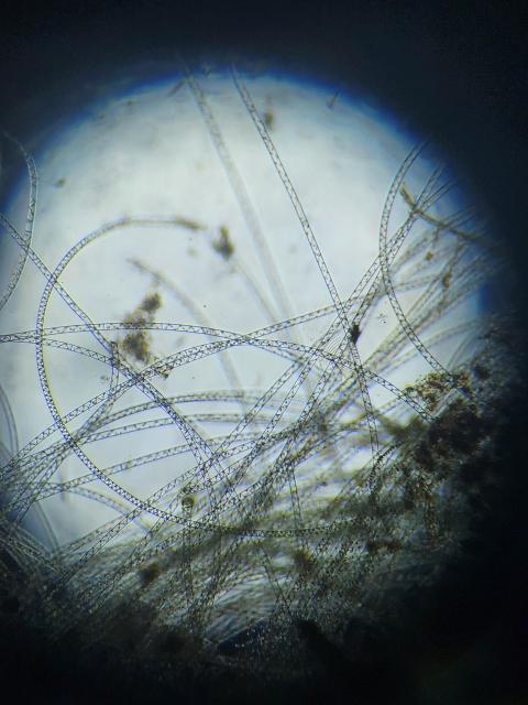 Probably spyrogyra - long chains of algae with spiral shaped structures inside