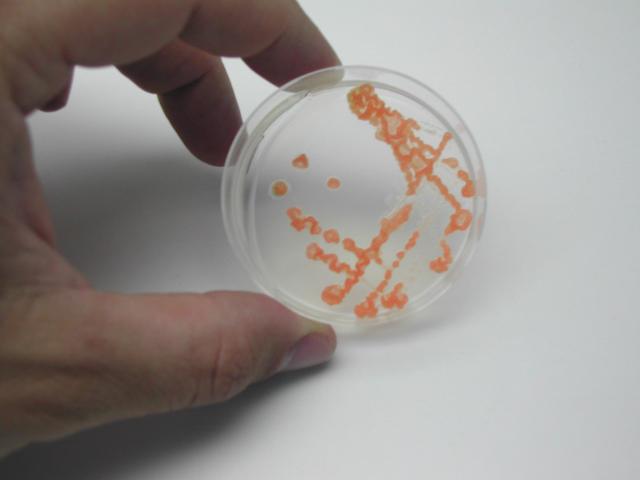 Hand holding a petri dish with red bacteria colonies. These are methane oxidizing bacteria.