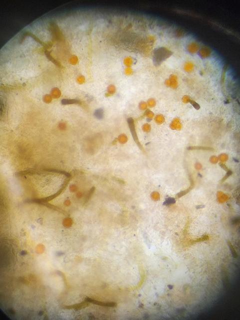 Microscope image. Is red spherical algae, surrounded by an assortment of other algae, some green and filamentous. Not as sharp as I would have liked.