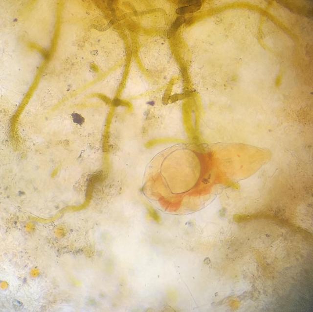 Another microscope image of a rotifer dyed red, presumably from eating H. pluvialis cells, surrounded by various other algae.