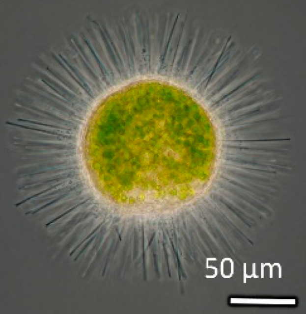 image/png a microscopic image of a spherical yellow organism filled with green dots and having numerous spines radiating from the surface. A scale of 50 microns indicates the sphere is about twice that measure. James L. Van Etten, Irina V. Agarkova, David D. Dunigan CC BY-SA 4.0.
https://commons.wikimedia.org/wiki/File:Viruses-12-00020-g001_Chlorella_Virus_(C).png#mw-jump-to-license