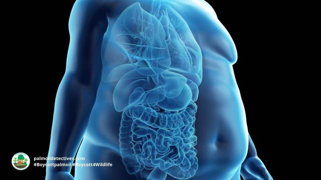 #News: Ultra-processed #foods #UPF are killing us for profit! 🧐🍔 #Lancet report warns global corporates drive chronic diseases for pure #greed and profit. We need tobacco-style tough laws to reclaim our #health! 🌴☠️🚫  #BoycottPalmOil @palmoildetect.bsky.social https://www.sciencedaily.com/releases/2025/11/251124025654.htm?utm_source=mastodon&utm_medium=Palm+Oil+Detectives&utm_campaign=publer