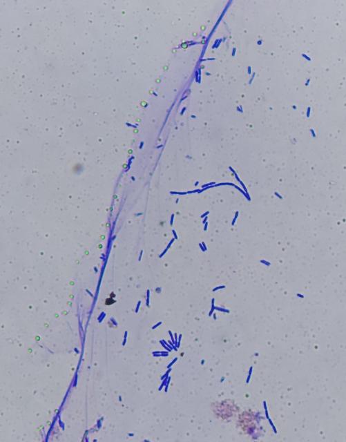 About a hundred rod-shaped bacteria stained dark violet. The bacteria generally come in pairs that are connected end to end. There's a ribbon of slimy stuff on the left that I think the bacteria have produced. There's also a string of greenish bubbles on the left side of the ribbon that might be air or oil bubbles.