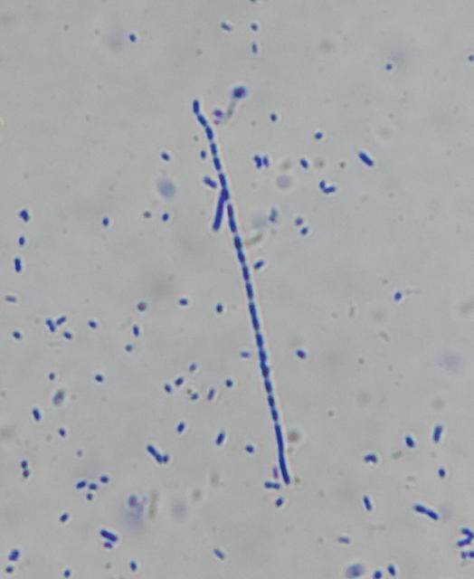 A long chain of about 25 stubby cylindrical bacteria, with about twice as many floating nearby