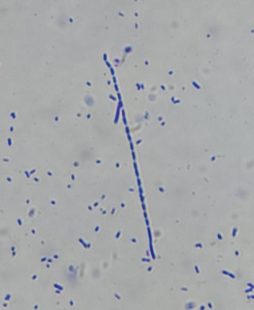 A long chain of about 25 stubby cylindrical bacteria, with about twice as many floating nearby